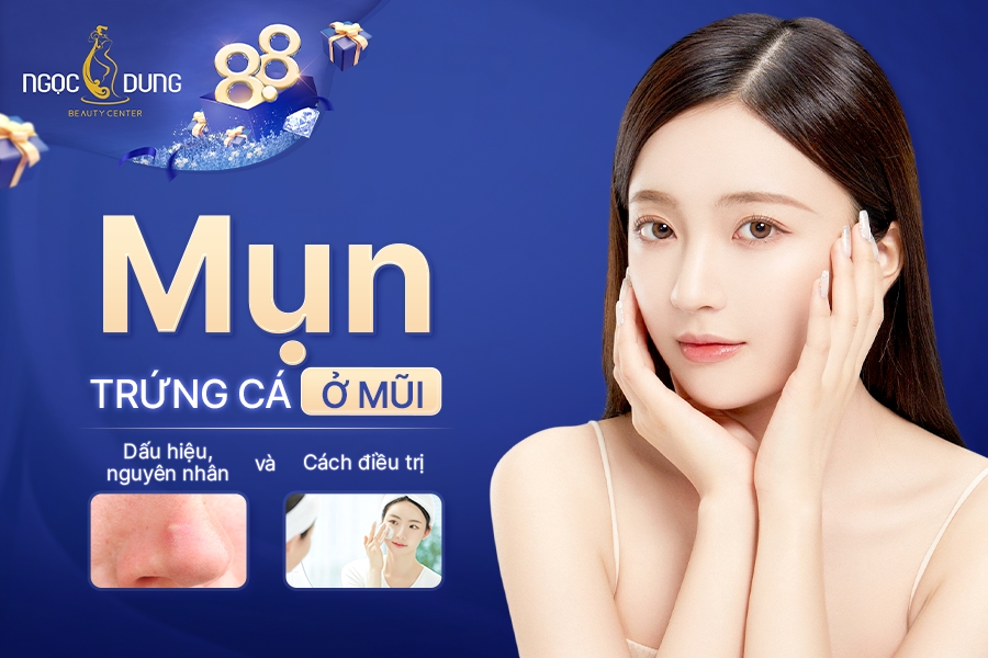 Mụn trứng cá ở mũi: Dấu hiệu, nguyên nhân và cách điều trị