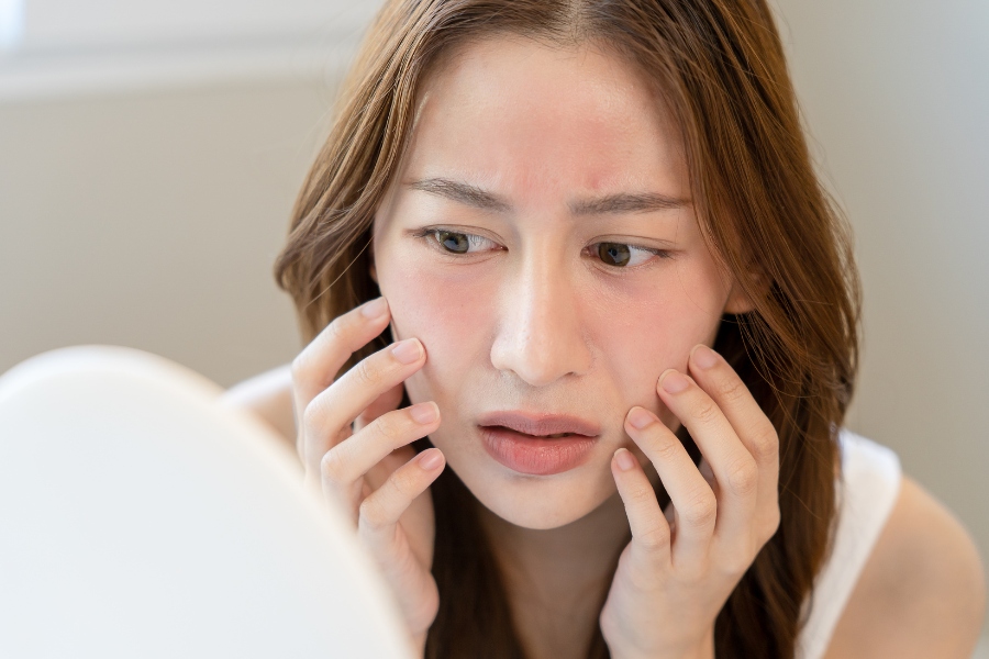 Hiểu rõ nguyên nhân, dấu hiệu sẽ giúp bạn biết cách skincare cho da nhạy cảm hiệu quả Hiểu rõ nguyên nhân, dấu hiệu sẽ giúp bạn biết cách skincare cho da nhạy cảm hiệu quả