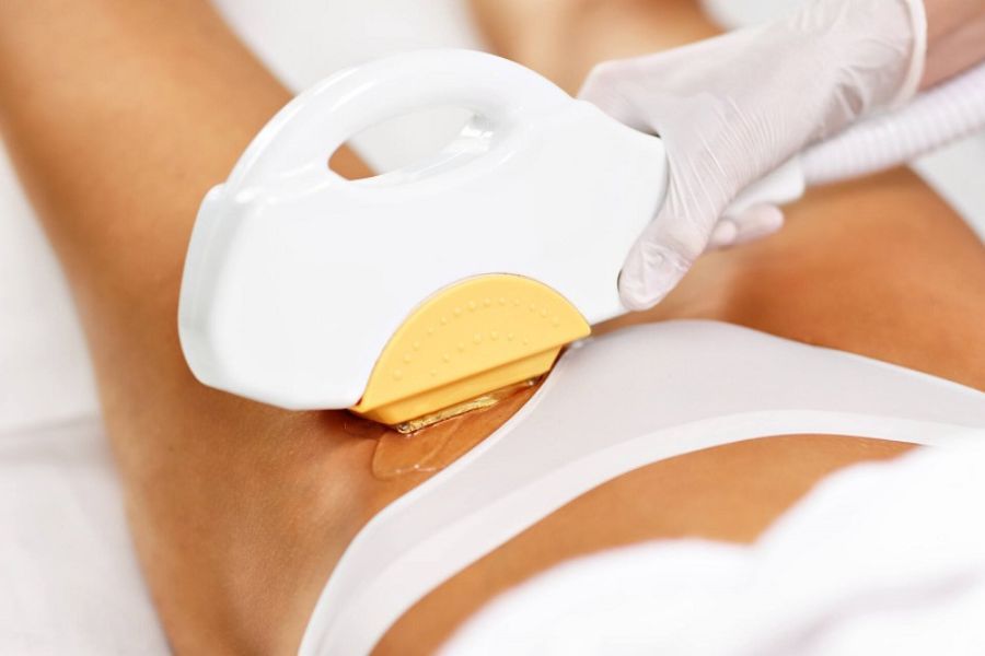 Địa chỉ triệt lông vùng kín ở Cần Thơ uy tín - TMV Ngọc Dung 7 Công nghệ triệt lông bikini New E-Light Pro tại TMV Ngọc Dung - Cần Thơ