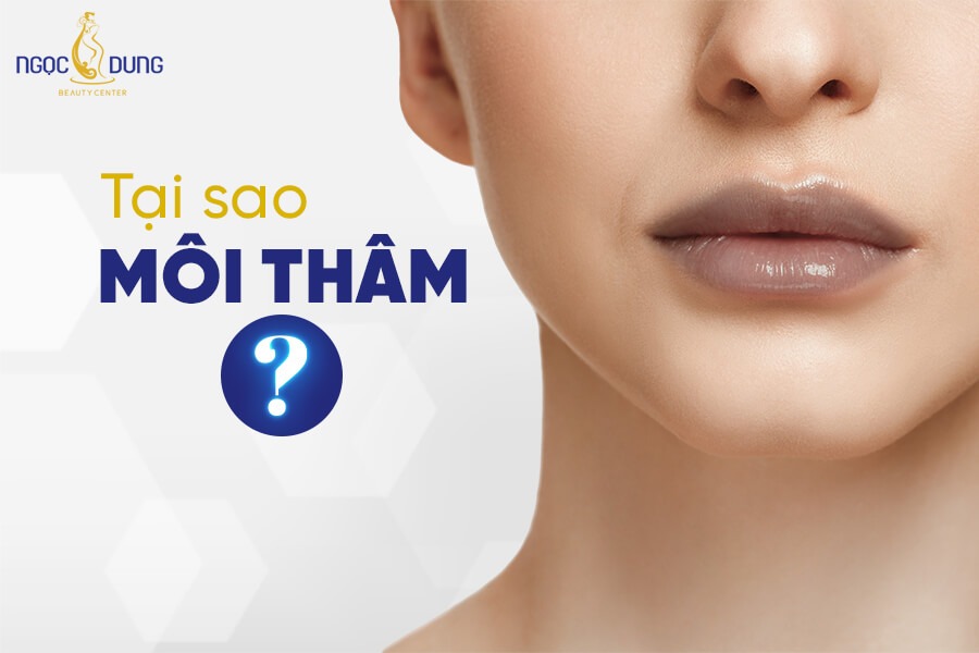 Khử thâm môi là gì? Các phương pháp khử thâm môi phổ biến hiện nay 4 Có nhiều nguyên nhân khiến đôi môi trở nên thâm sạm