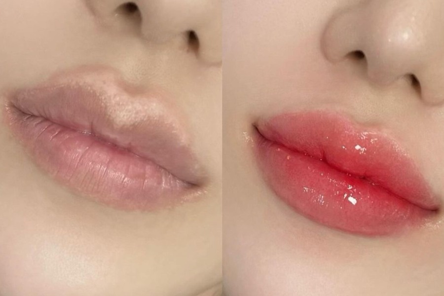 Khử thâm môi là gì? Các phương pháp khử thâm môi phổ biến hiện nay 16 Khử thâm môi giúp đôi môi hồng hào căng mọng