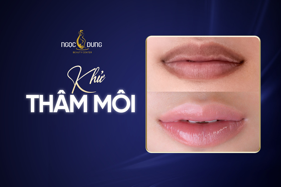 Khử thâm môi là gì? Các phương pháp khử thâm môi phổ biến hiện nay 2 khử thâm môi