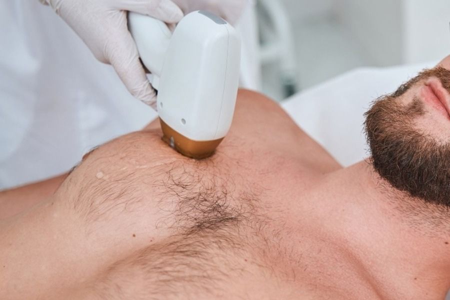 Địa chỉ triệt lông vĩnh viễn ở Bình Dương - TMV Ngọc Dung 12 Nam giới nên triệt lông vĩnh viễn để gọn gàng, thoải mái hơn