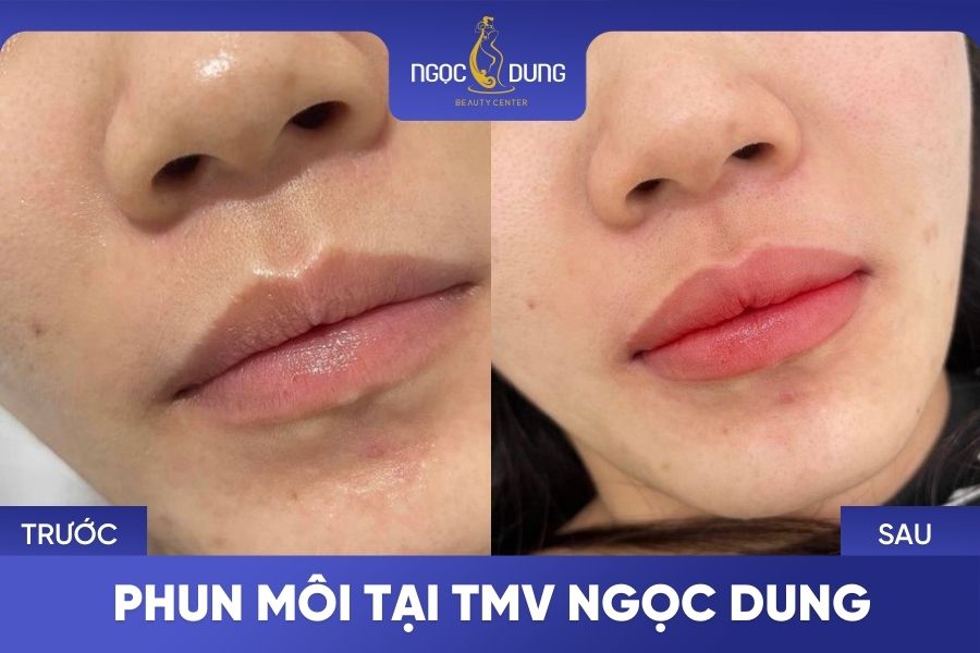 hinh anh phun moi tai TMV Ngoc Dung