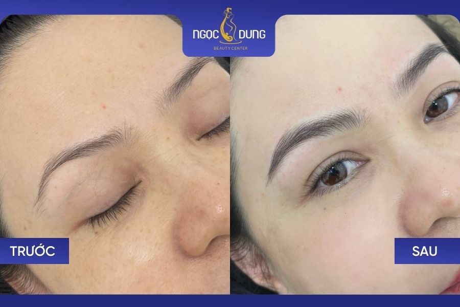 Ưu nhược điểm điêu khắc chân mày và những điều cần lưu ý 7 Hình ảnh trước và sau khi điêu khắc chân mày tại TMV Ngọc Dung