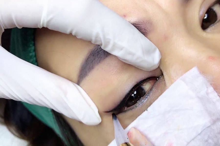 Phun mí mắt giá bao nhiêu? Bảng giá phun mí mắt mới nhất 2026 9 Sự an toàn và sức khỏe nên đặt lên hàng đầu khi bạn quyết định đinh làm đẹp