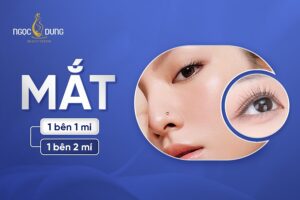 Mắt 1 bên 1 mí 1 bên 2 mí