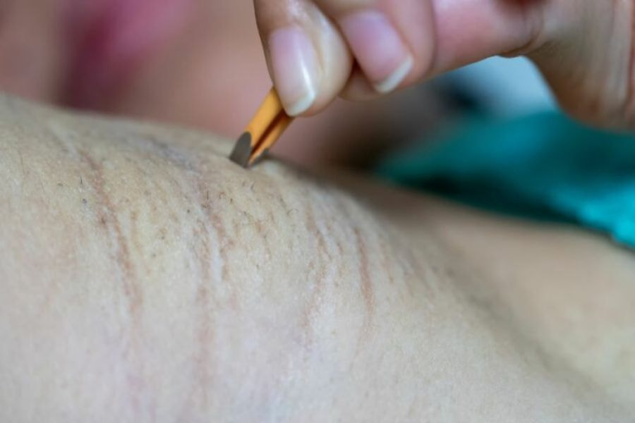 Nhổ lông nách bằng nhíp tại nhà