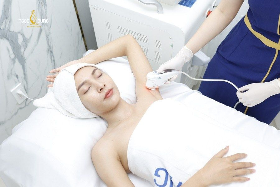 Triệt lông Diode Laser: Công nghệ vượt trội giúp da sáng mịn 6 Ngọc Dung mang đến liệu trình triệt lông với công nghệ Diode Laser mới nhất