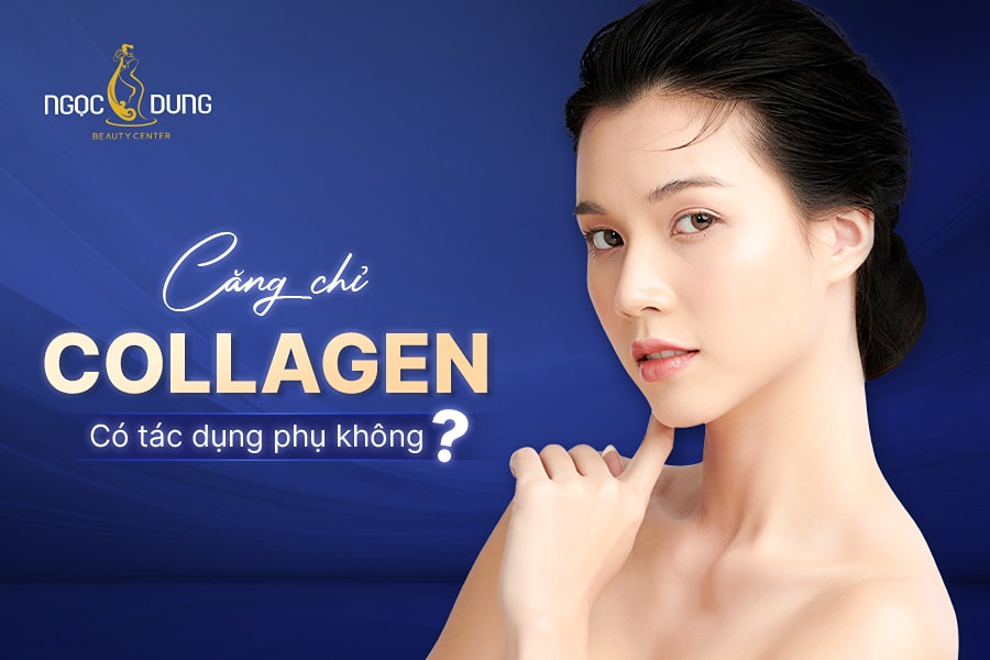 Căng chỉ collagen có tác dụng phụ không?
