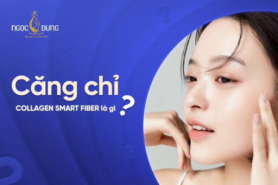 Căng chỉ collagen smart fiber