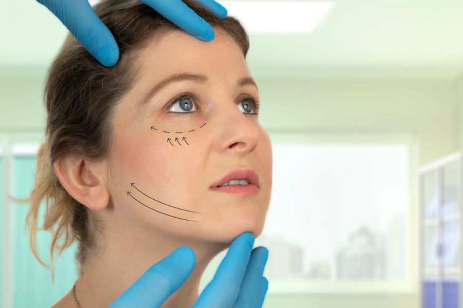 Khách hàng dễ gặp biến chứng khi căng chỉ collagen ở cơ sở thẩm mỹ không uy tín