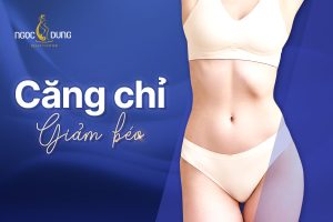 căng chỉ giảm béo