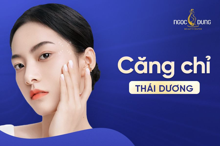 căng chỉ thái dương