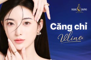 Những Điều Cần Biết Trước Khi Làm Căng Chỉ Vline