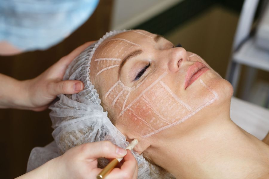 Căng da chỉ vàng mang lại hiệu quả trẻ hóa nhanh và lâu hơn các phương pháp thông thường