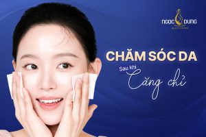 Lưu Ý Quan Trọng Trong Chăm Sóc Da Sau Căng Chỉ
