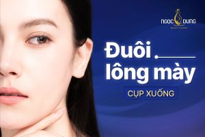 Đuôi lông mày cụp xuống
