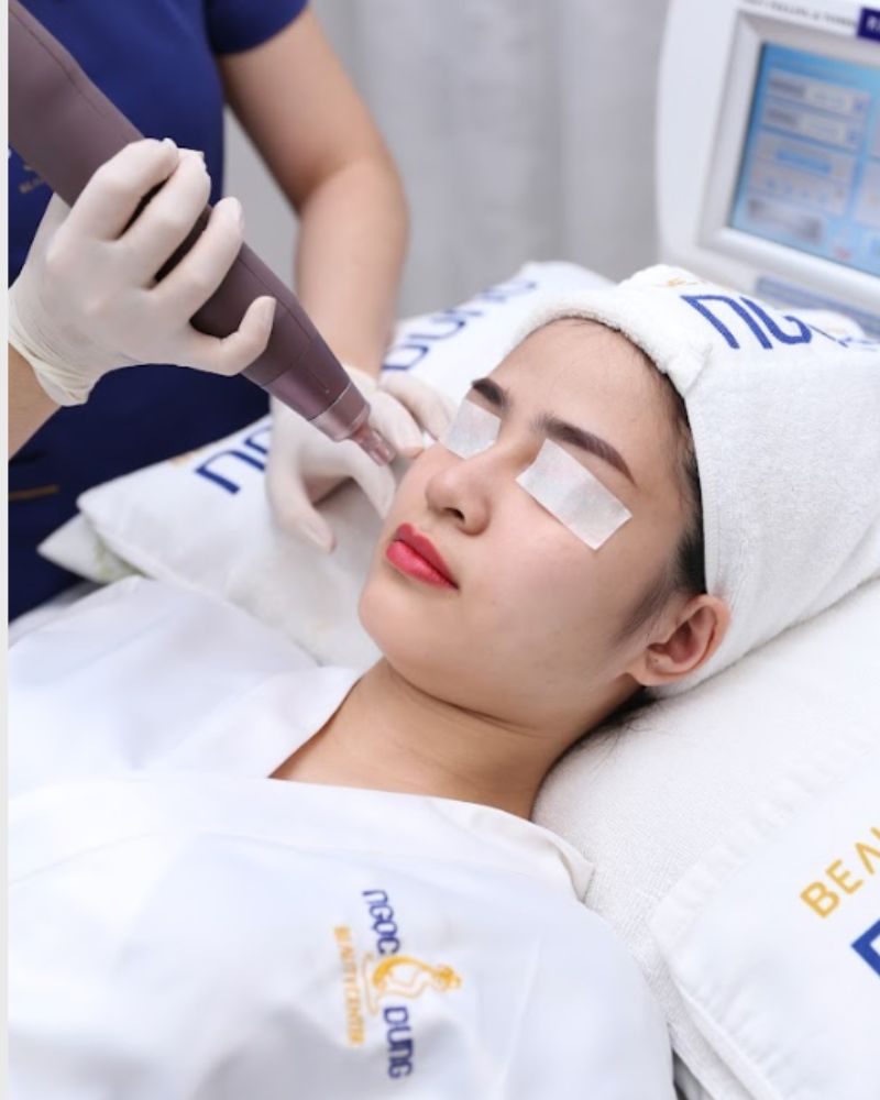 Trị nám cánh bướm bằng laser công nghệ cao