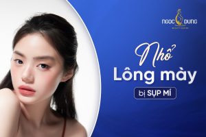 Nhổ lông mày bị sụp mí