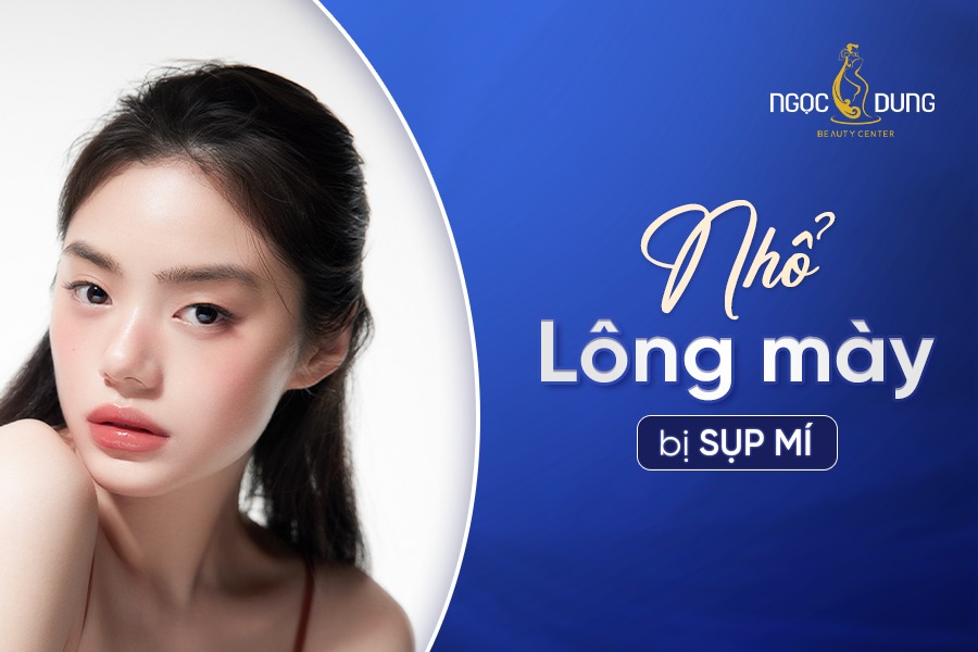 Nhổ lông mày bị sụp mí