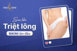 sau khi triệt lông bikini lần đầu