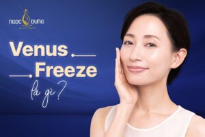 venus freeze la gi 1