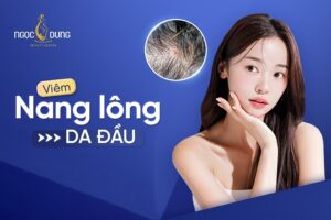 Viêm nang lông da đầu