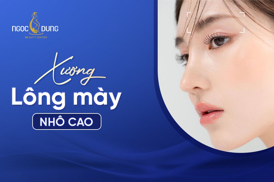 Xương lông mày nhô cao
