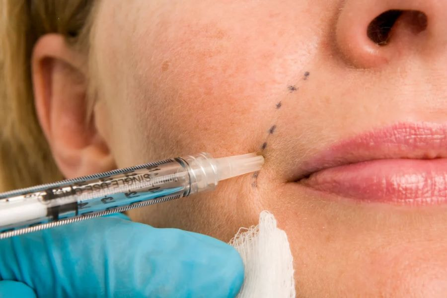 Đừng nên ham rẻ mà hãy ưu tiên những nơi làm căng chỉ rãnh cười uy tín và hiệu quả