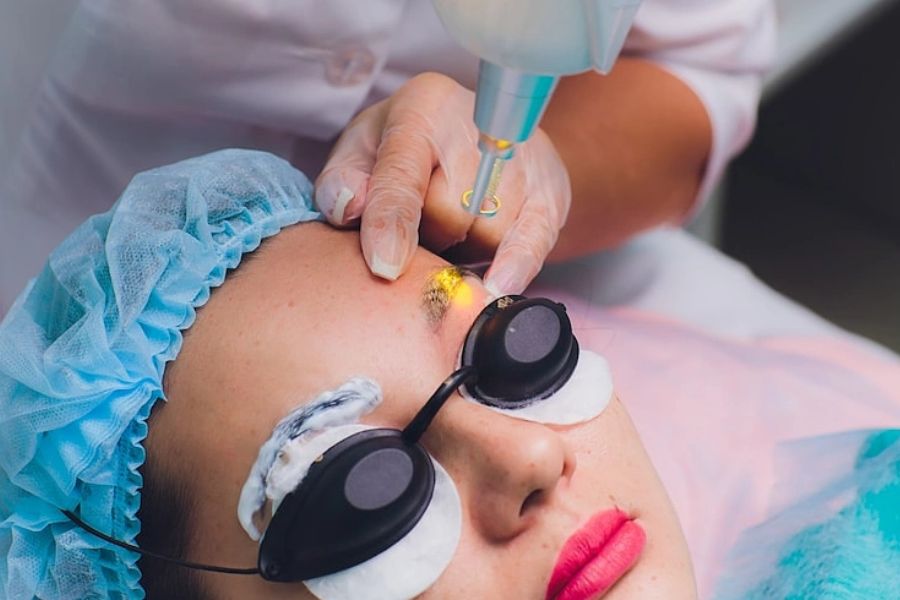 Chi phí xóa xăm chân mày bằng laser phụ thuộc vào nhiều yếu tố khác nhau