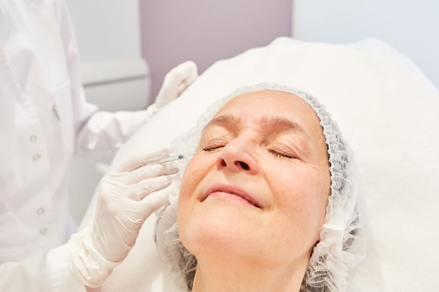 Căng chỉ rãnh cười có thể duy trì hiệu quả từ 1 - 3 năm