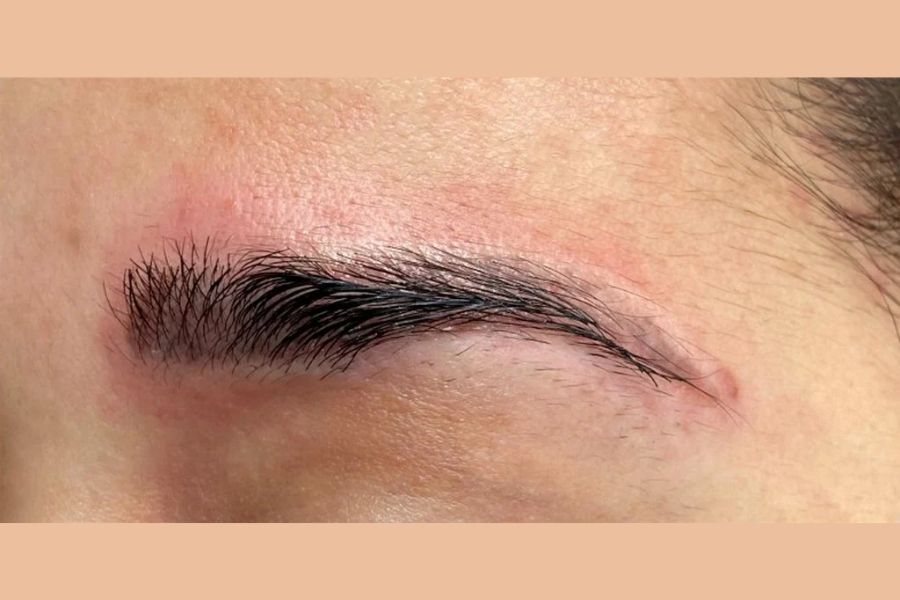 Phun lông mày bị sưng mắt: Nguyên nhân & cách khắc phục 8 Kỹ thuật phun xăm cũ thường tác động nhiều vào da, gây ra tình trạng sưng tấy