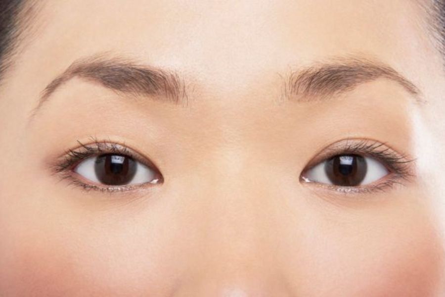 Lông mày cách xa mắt có thể khiến tổng thể khuôn mặt bạn không hài hòa