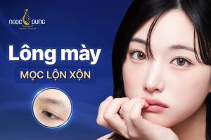 Lông mày mọc lộn xộn
