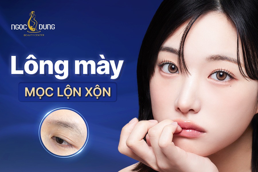 Lông mày mọc lộn xộn