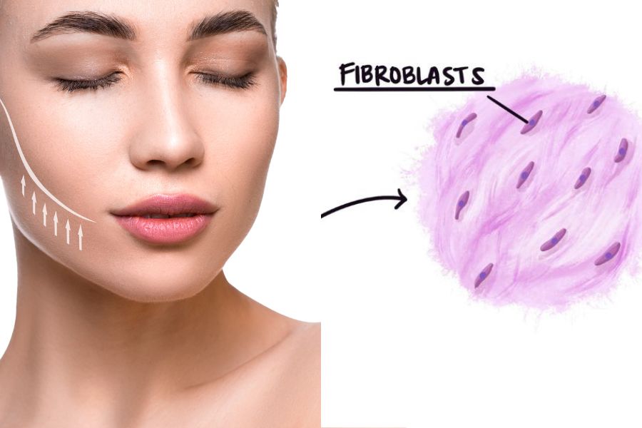 Công nghệ nguyên bào sợi là một phương pháp thẩm mỹ tiên tiến bậc nhất hiện nay