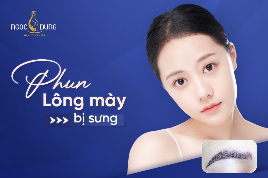 Phun lông mày bị sưng