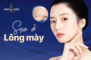 Sẹo ở lông mày