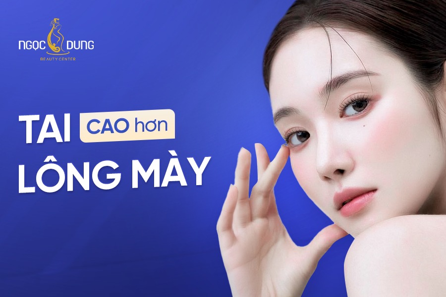 Tai cao hơn lông mày