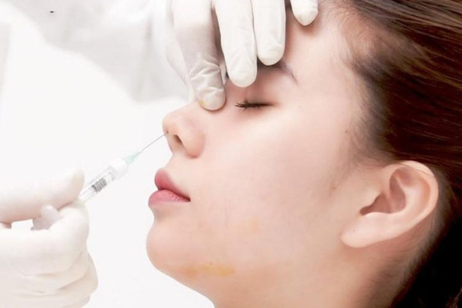 Nguyên Nhân Gây Biến Chứng Tiêm Filler Và Cách Phòng Tránh 9 Tiêm filler theo quy trình chuẩn y khoa sẽ hạn chế tối đa nguy cơ nhiễm trùng