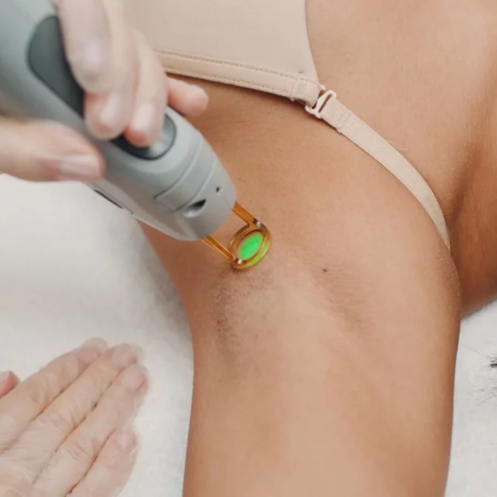 Trị viêm nang lông tại TMV Ngọc Dung