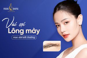 Lông mày mọc dài bất thường