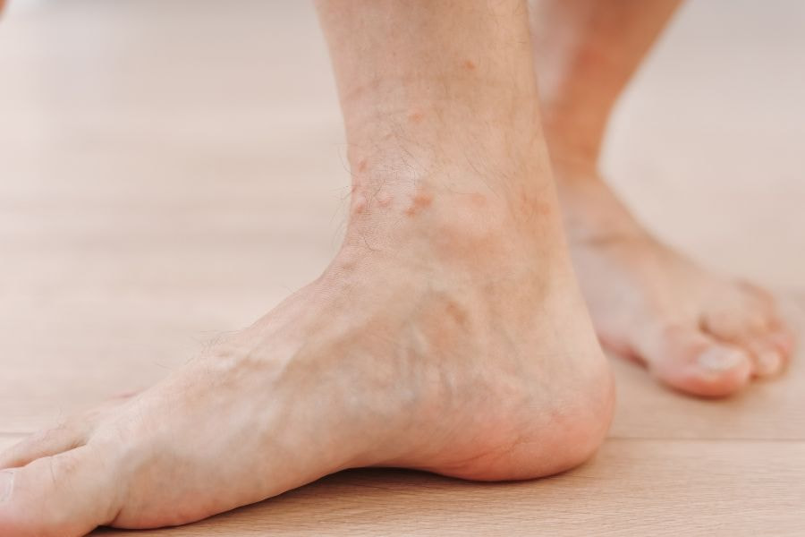 Thuốc triệt lông vĩnh viễn có hiệu quả và an toàn không? 10 Triệt lông không đúng cách dễ gây ra tình trạng lông mọc ngược