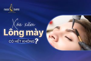 Xóa xăm lông mày có hết không