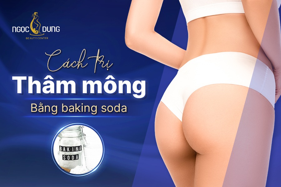 cách trị thâm mông bằng baking soda