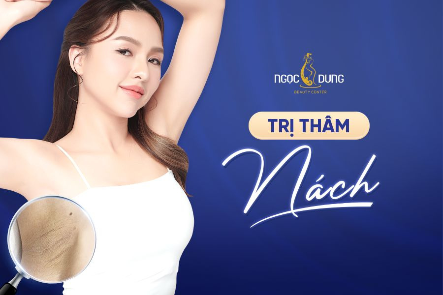 Trị nách hết thâm bằng Laser tại Thẩm mỹ viện Ngọc Dung