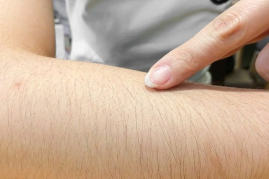 Cách tẩy lông tay tại nhà hiệu quả và những lưu ý cần biết 2 Lông tay nhiều gây mất thẩm mỹ