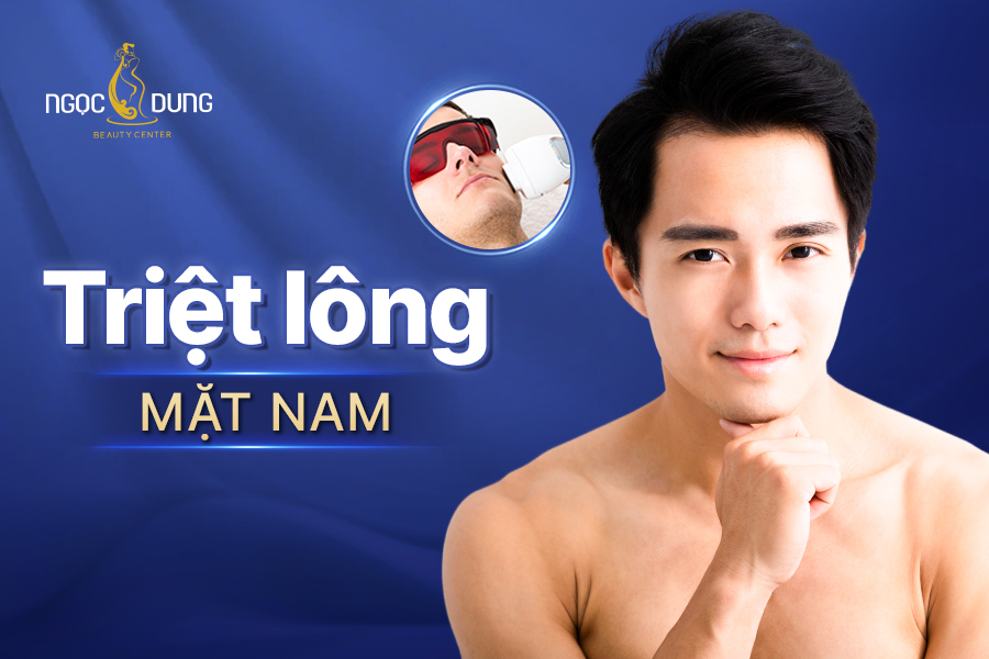 Triệt lông mặt nam