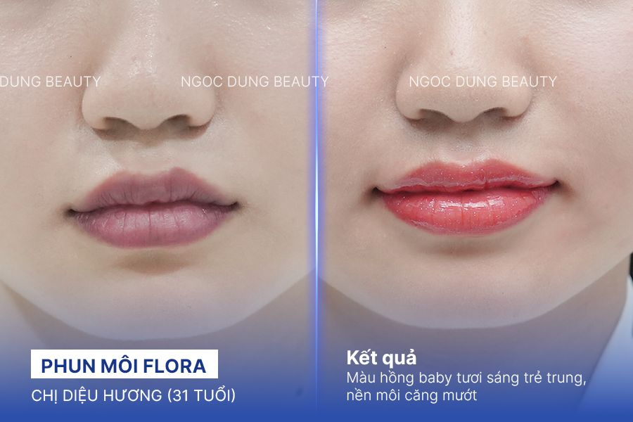 Chị Diệu Hương (31 tuổi) - Phun Môi Flora